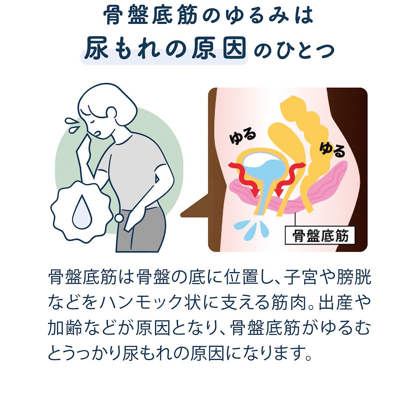 フェリシモの雑貨 Kraso|尿もれ・頻尿対策に！　ショーツの上から骨盤底筋の引き上げアシスト　メディカルサポーター〈ブラック〉の会