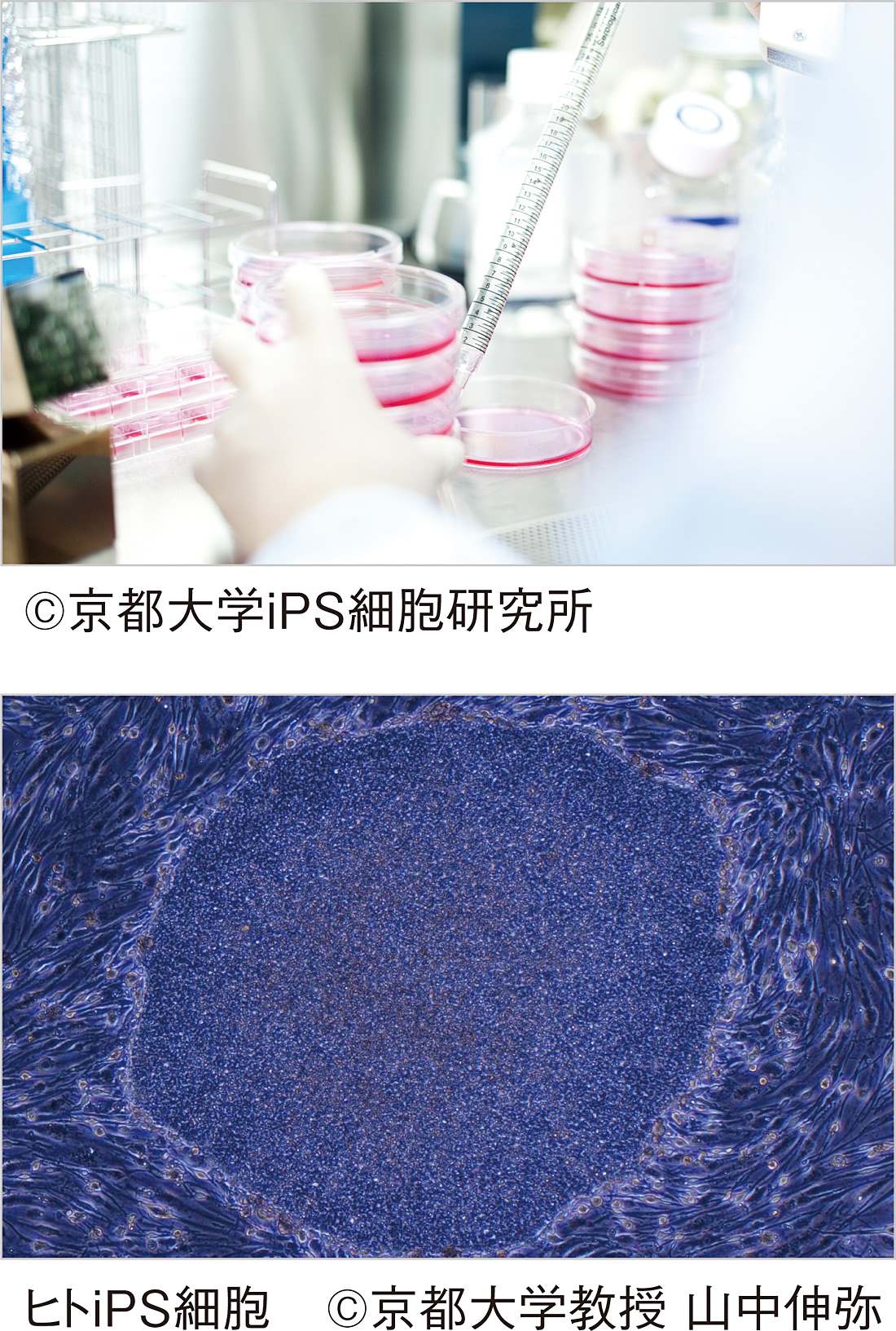 iPS細胞研究支援